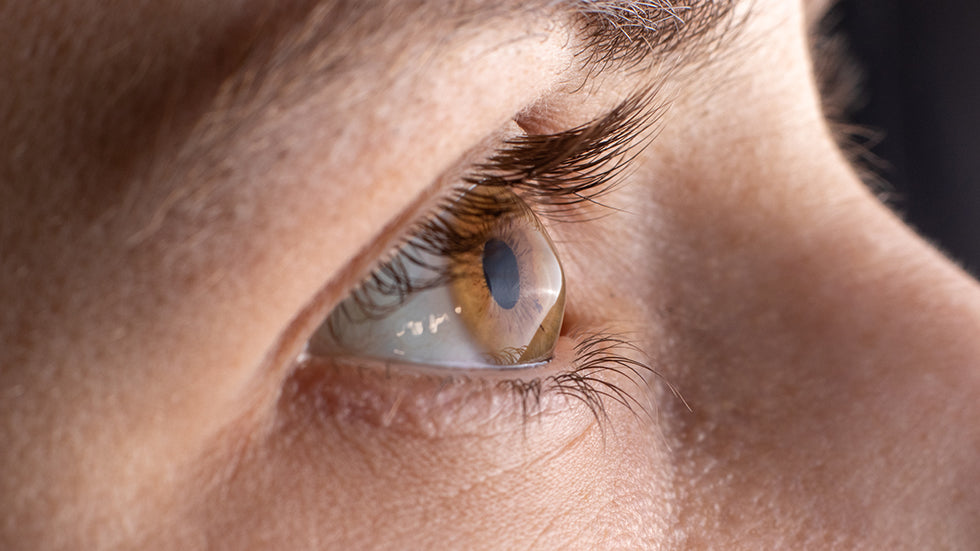 keratoconus, an ocular condition that affects a person's sight