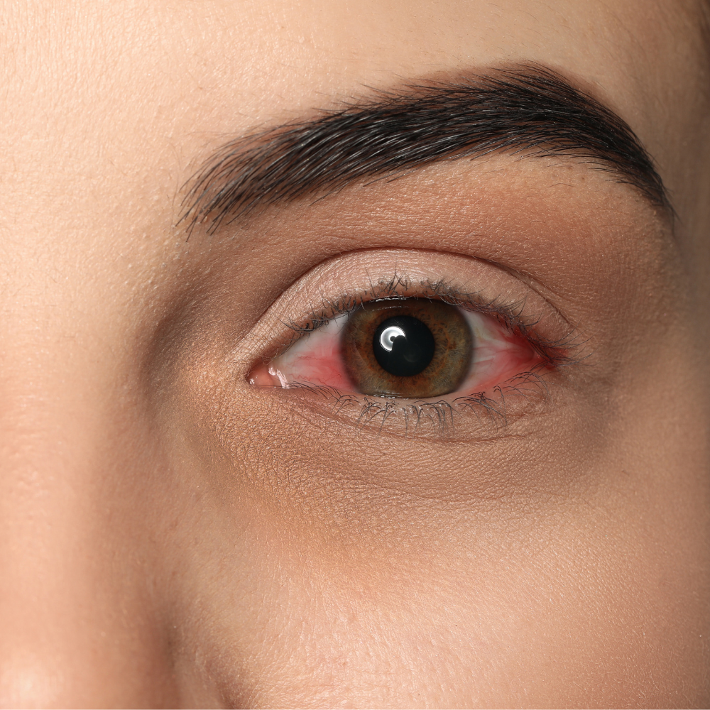 Lens Problems What Causes Common Contact Lens Problems | Tangible Science